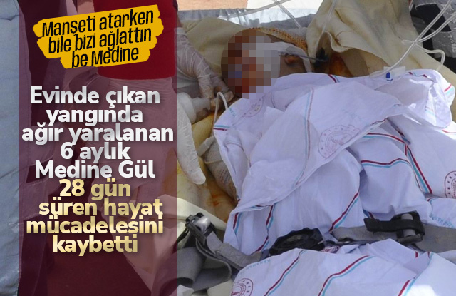 6 aylık Medine 28 günlük yaşamı kaybetti